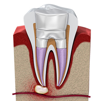 Endodontics